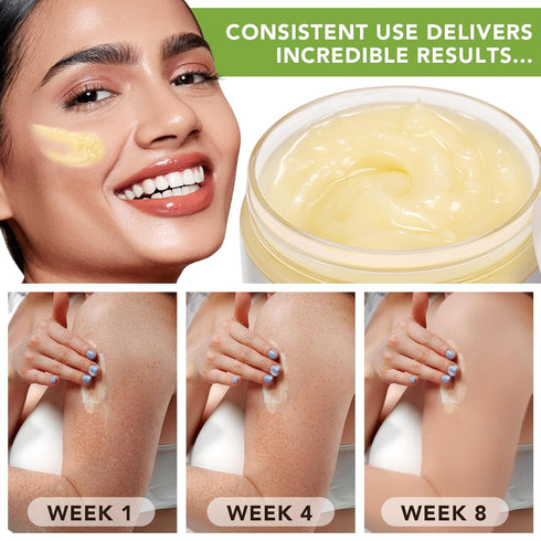ITSDAWN 7.8 Oz Shea Butter Raw Organic, Raw Unrefined Shea Butter Lotion for Body, Face & Hair, Long-lasting Hydration