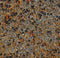 No-Till Cover Crop 13-Seed Mix (1 lb. Bag): [50% Clovers Plus Fenugreek,